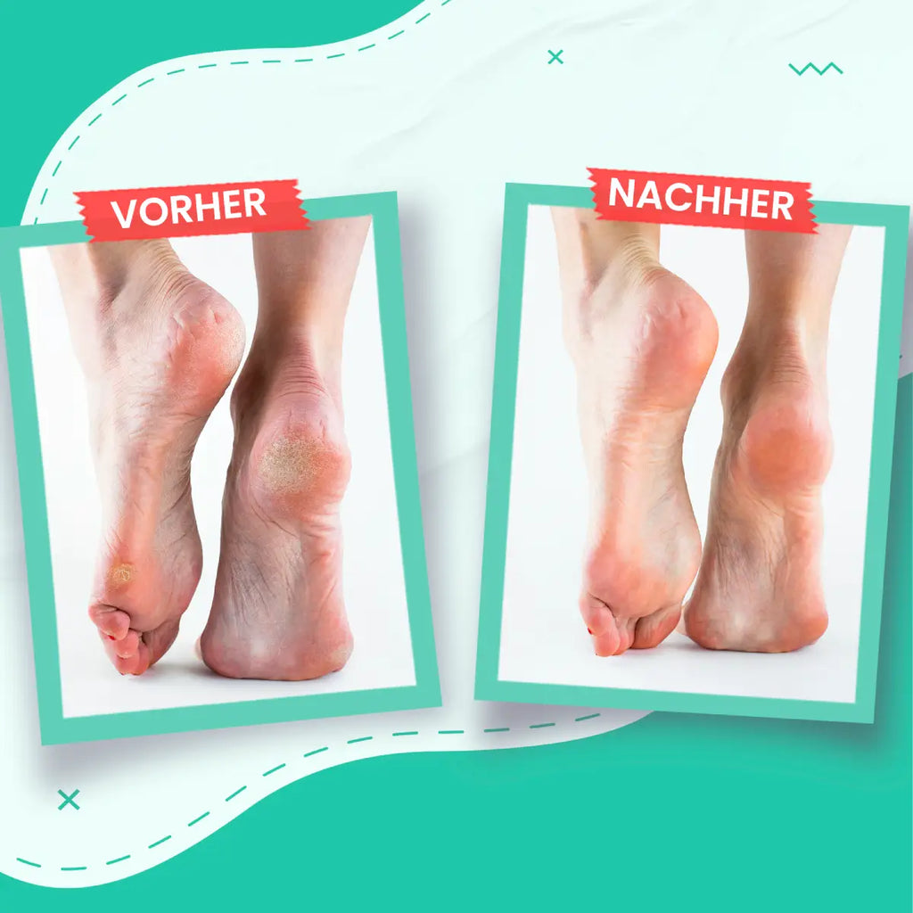 Fußcreme Für Trockene & Rissige Haut-4