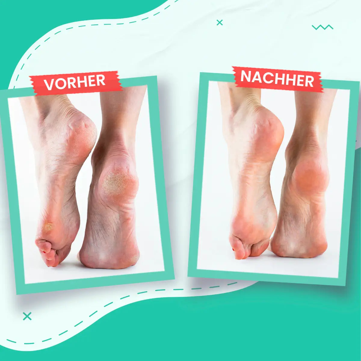 Fußcreme Für Trockene & Rissige Haut-4